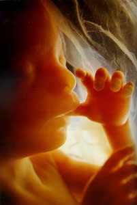 photo of human fetus